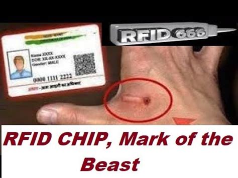 rfid chip that burns if person disobeys|illegal rfid chip implantation.